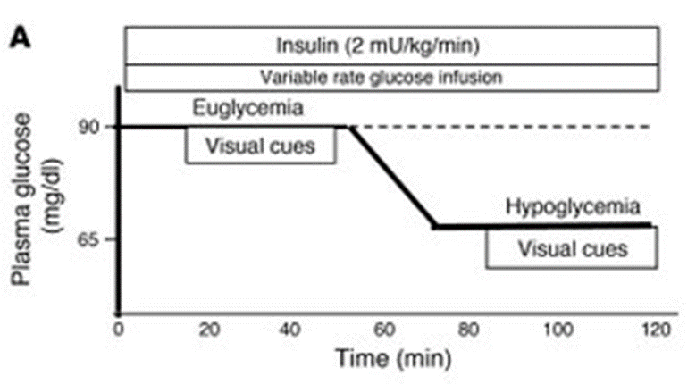 Glucose-clamp protocol and timing of visual food cues.